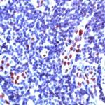 PML Antibody in Immunohistochemistry (IHC)