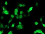 PMVK Antibody in Immunocytochemistry (ICC/IF)