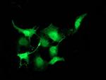 PNMT Antibody in Immunocytochemistry (ICC/IF)