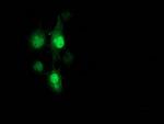 PNMT Antibody in Immunocytochemistry (ICC/IF)