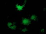 PNMT Antibody in Immunocytochemistry (ICC/IF)