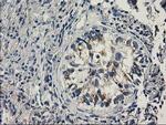 PNMT Antibody in Immunohistochemistry (Paraffin) (IHC (P))