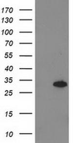 PNMT Antibody in Western Blot (WB)