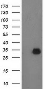 PNMT Antibody in Western Blot (WB)