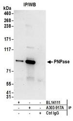 PNPase Antibody in Western Blot (WB)