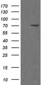 POGK Antibody in Western Blot (WB)