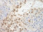 POGZ Antibody in Immunohistochemistry (IHC)