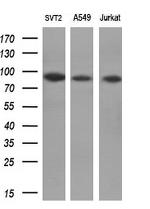 POLI Antibody in Western Blot (WB)