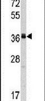 POLR1C Antibody in Western Blot (WB)