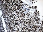 POLR2A Antibody in Immunohistochemistry (Paraffin) (IHC (P))