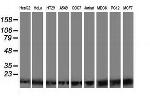 POLR2J2 Antibody in Western Blot (WB)