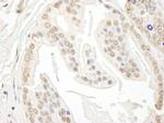 POLR3D Antibody in Immunohistochemistry (IHC)