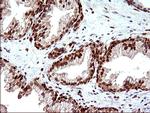 POLR3GL Antibody in Immunohistochemistry (Paraffin) (IHC (P))