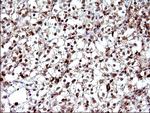 POLR3GL Antibody in Immunohistochemistry (Paraffin) (IHC (P))