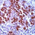 POMC Antibody in Immunohistochemistry (IHC)