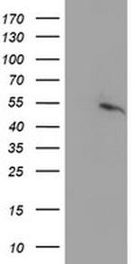 PPARA Antibody in Western Blot (WB)