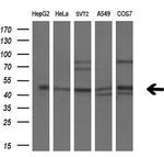 PPARA Antibody in Western Blot (WB)