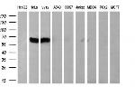 PPARA Antibody in Western Blot (WB)