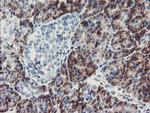 PPIL6 Antibody in Immunohistochemistry (Paraffin) (IHC (P))