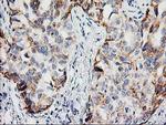 PPM1B Antibody in Immunohistochemistry (Paraffin) (IHC (P))