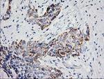 PPM1B Antibody in Immunohistochemistry (Paraffin) (IHC (P))