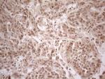 PPP1CA Antibody in Immunohistochemistry (Paraffin) (IHC (P))