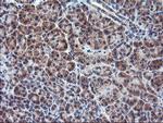 PPP1R15A Antibody in Immunohistochemistry (Paraffin) (IHC (P))