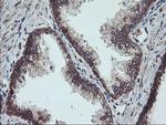 PPP1R15A Antibody in Immunohistochemistry (Paraffin) (IHC (P))