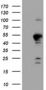 PPP1R15A Antibody in Western Blot (WB)