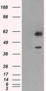 PPP1R7 Antibody in Western Blot (WB)