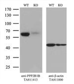 PPP2R1B Antibody