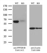 PPP2R1B Antibody in Western Blot (WB)