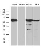 PPP2R1B Antibody in Western Blot (WB)