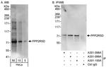 PPP2R5D Antibody in Western Blot (WB)