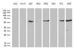 PPP3CB Antibody in Western Blot (WB)