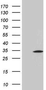 PRELID1 Antibody in Western Blot (WB)