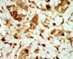 AMPK gamma-3 Antibody in Immunohistochemistry (IHC)