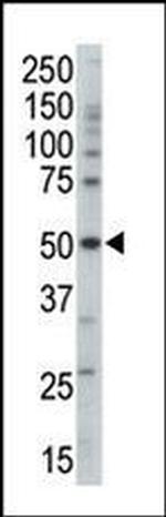 AMPK gamma-3 Antibody in Western Blot (WB)