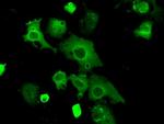 PRKAR2A Antibody in Immunocytochemistry (ICC/IF)