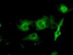 PRKAR2A Antibody in Immunocytochemistry (ICC/IF)