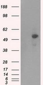 PRKAR2A Antibody in Western Blot (WB)