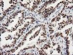 PRKCE Antibody in Immunohistochemistry (Paraffin) (IHC (P))