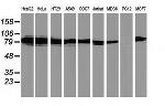 PRKCE Antibody in Western Blot (WB)