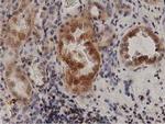 PRKD2 Antibody in Immunohistochemistry (Paraffin) (IHC (P))