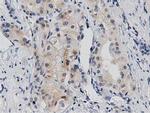 PRKD2 Antibody in Immunohistochemistry (Paraffin) (IHC (P))