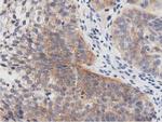 PRKD2 Antibody in Immunohistochemistry (Paraffin) (IHC (P))