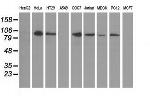 PRKD2 Antibody in Western Blot (WB)