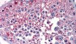 PRKD3 Antibody in Immunohistochemistry (Paraffin) (IHC (P))