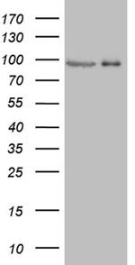 PRKG2 Antibody in Western Blot (WB)