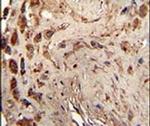 PACT Antibody in Immunohistochemistry (IHC)